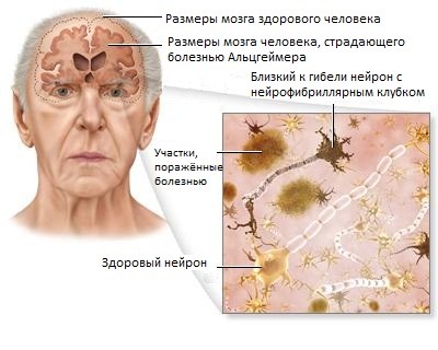 Проверка на альцгеймера картинка с животными